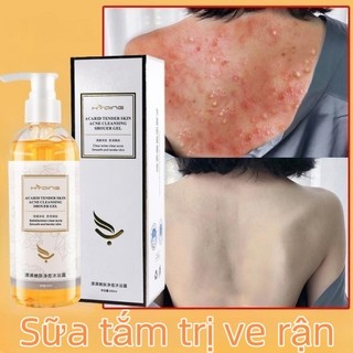 Sữa tắm trị mụn sữa tắm da mụn sữa tắm cho da mụn sửa tắm mụn lưng sữa tắm làm trắng da sữa tắm hết mụn lưng