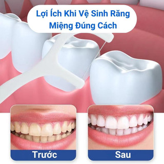 ✅ Tăm chỉ nha khoa (hộp 50 cái)