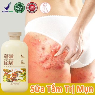  Sữa tắm trắng da Sữa tắm mụn lưng Sữa tắm loại bỏ mụn 500ml Loại bỏ kháng khuẩn và ve Loại bỏ mụn trứng cá và ve ngứa 