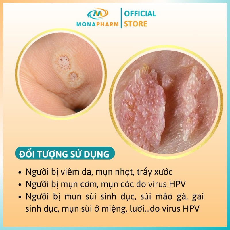 Kem Bôi Sùi Mào Gà Mụn Cóc HUPAVIR Ointment Giúp Giảm Viêm Da, Mụn Cơm 20g
