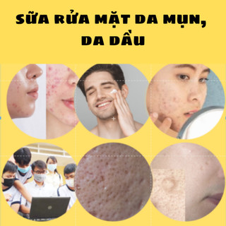 Sữa rửa mặt cho da mụn da dầu nhiều
