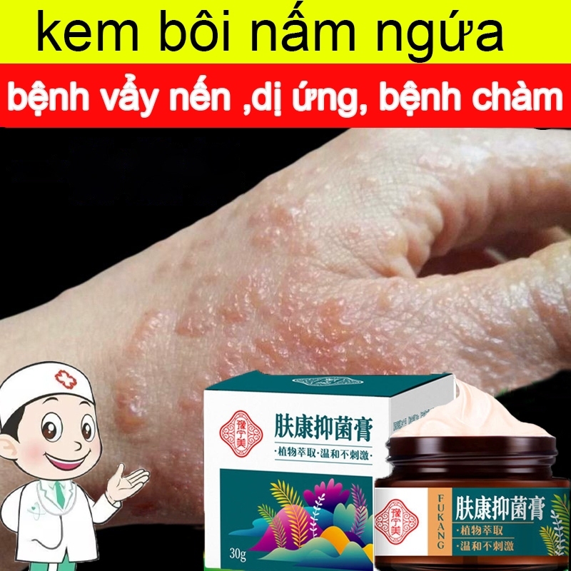 kem bôi nấm ngứa kem bôi ngoài da ghẻ ngứa Kem chống ngứa 30g kem bôi chàm Kem bôi vảy nến