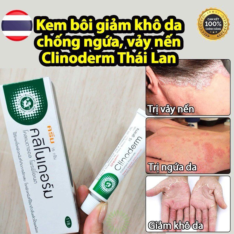 Kem Bôi Ngứa Vảy Nến Thái Lan Clinoderm Cream 15g hàng order thái