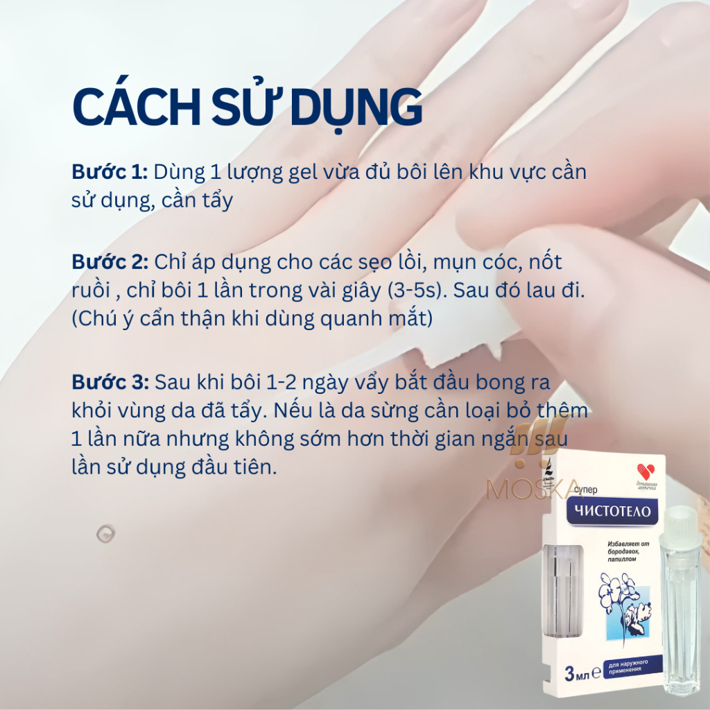 Tẩy Nốt Ruồi, Mụn Thịt, Mụn Cóc, Sẹo Lỗi và Tất Cả Loại Mụn, Đánh bay Các Loại Mụn Của Nga Dvelinil| Mosks Shop