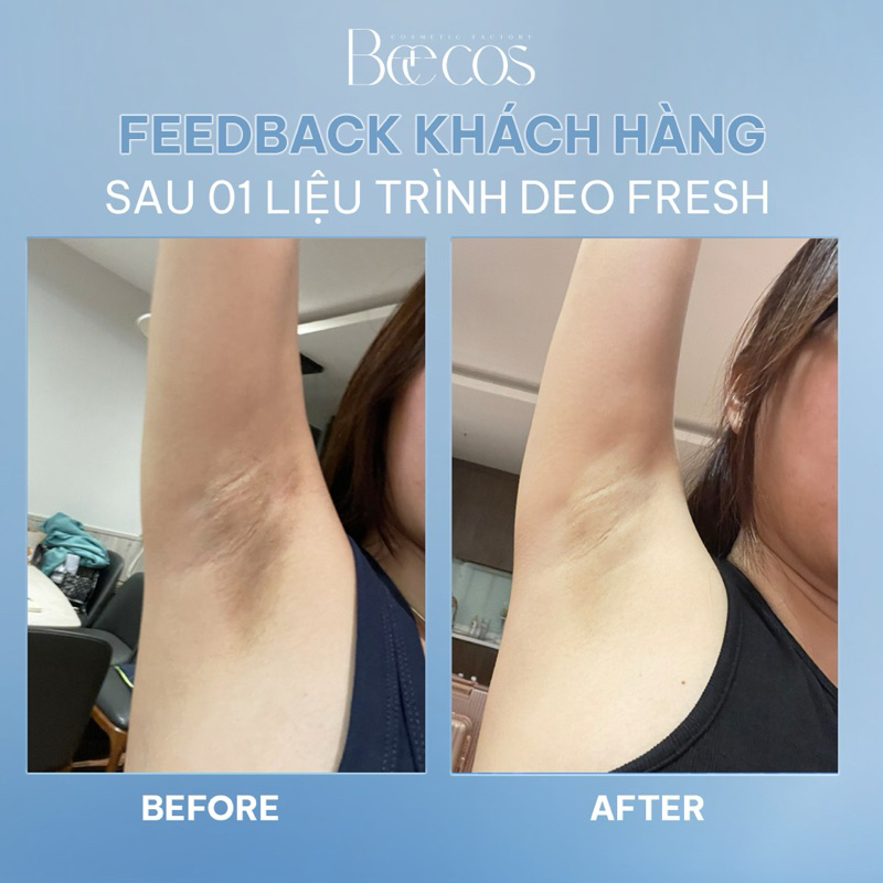 Gạc Lau Khử Mùi Beecos Deo Fresh Khử Mùi Hôi Chân Hôi Nách Ngăn Tiết Mùi Hôi Đến 72h - Fullsize