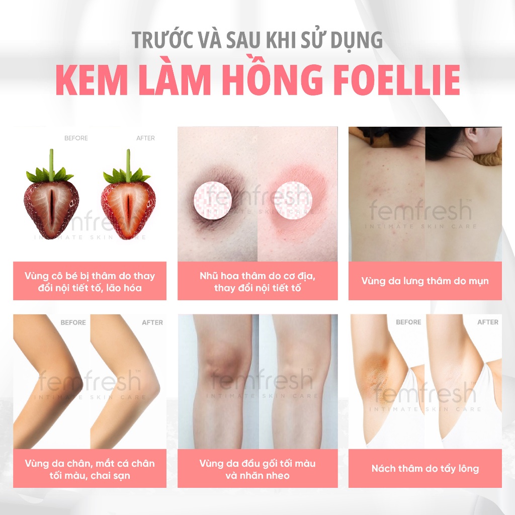 [COMBO TỰ TIN] Xịt Thơm Mát, Khử Mùi Vùng Kín Femfresh + Kem làm hồng vùng kín Foellie combo giúp chị em toả sáng