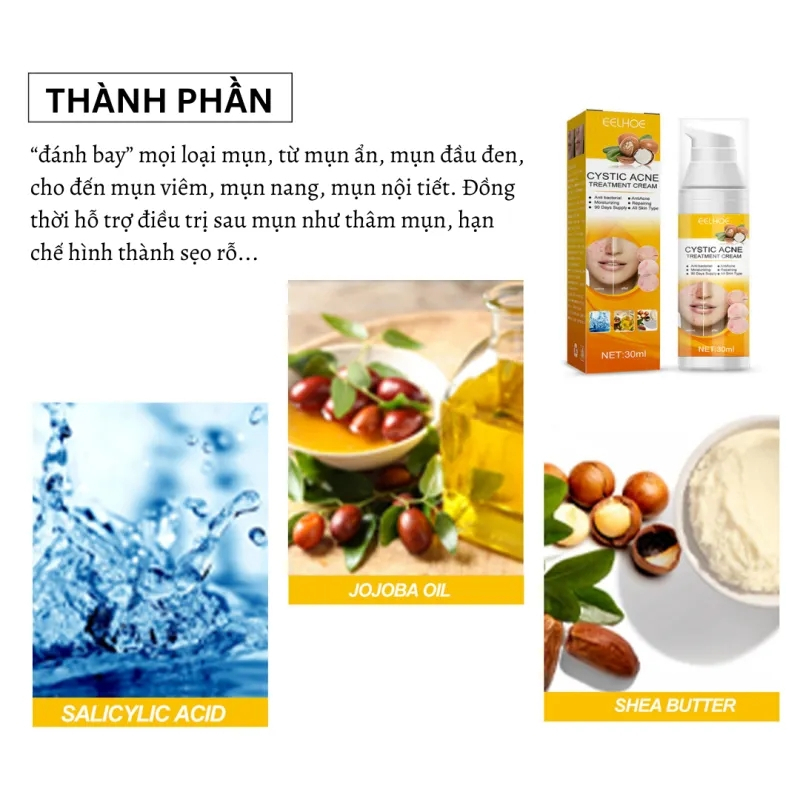 Tinh Chất Đào Thải Mụn Xóa Thâm Sẹo CYSTIC ACE - Xịt Thảo Dược CYSTIC ACE, Cải Thiện Da Mụn, Thu Nhỏ Lỗ Chân Lông