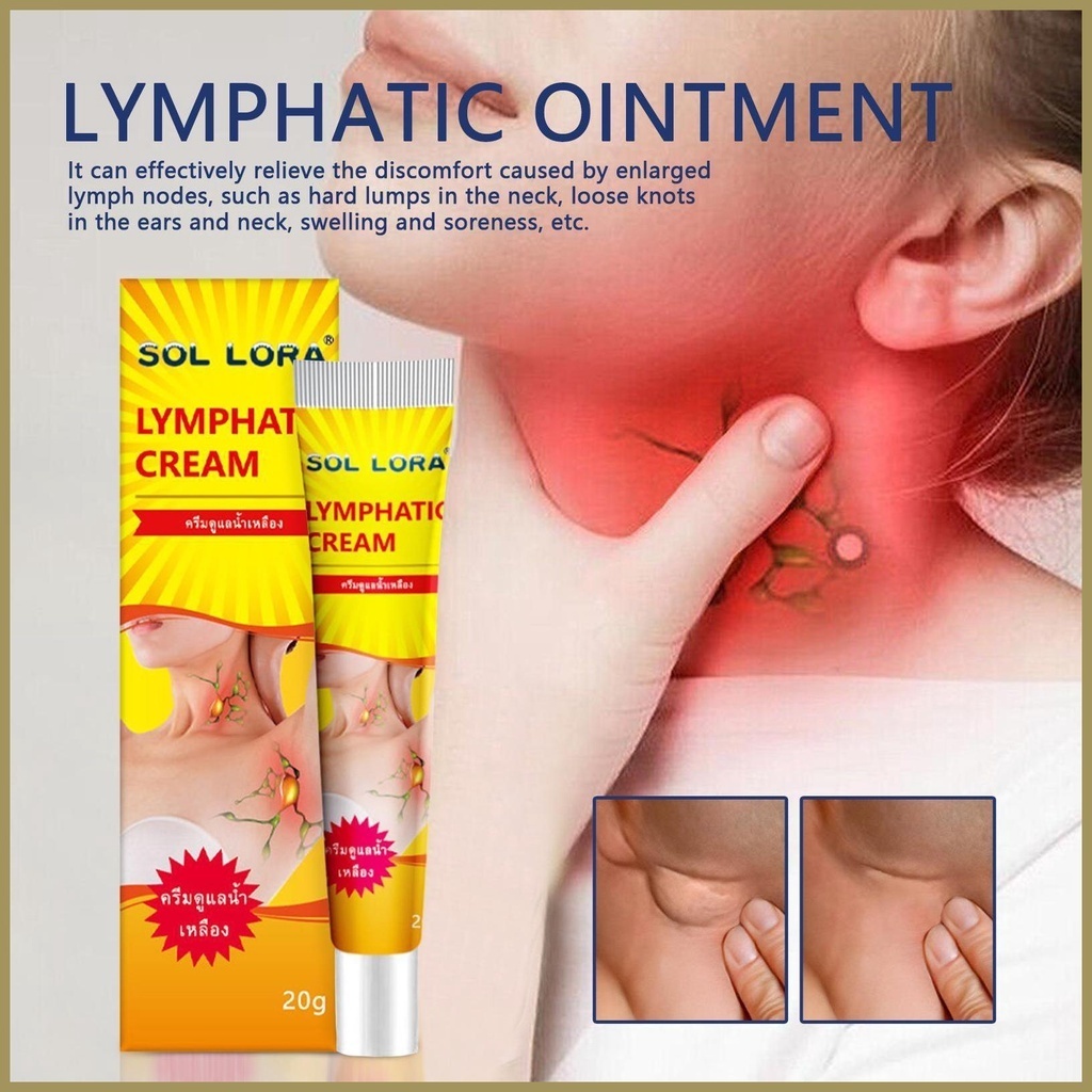 Kem Tan Hạch SOL LORA LYMPHATIC CREAM, Kem SOL LORA Hỗ Trợ Tiêu Hạch, U Mỡ, Hạch Bạch Huyết, U Bã Đậu