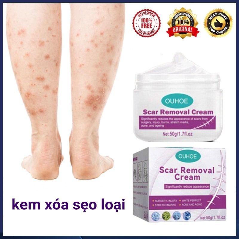 Kem Bôi Sẹo Kem Mờ Sẹo Thâm,mờ sẹo,bôi sẹo,mờ thâm sẹo,liền sẹo và sẹo mụn 50G