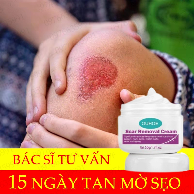 Kem Bôi Sẹo Kem Mờ Sẹo Thâm,mờ sẹo,bôi sẹo,mờ thâm sẹo,liền sẹo và sẹo mụn 50G