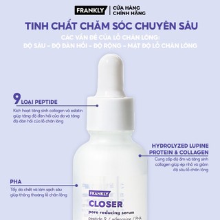 Tinh chất Frankly Serum 30ml