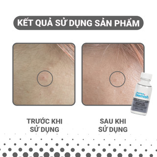 Lotion Chấm Mụn Bye Bye Blemish Volcanic Ash Drying Lotion