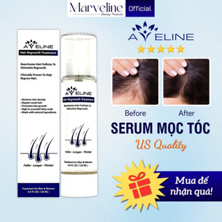 [Công thức mới] Thuốc kích mọc tóc nhanh Aveline Hair Regrowth Treatment của Mỹ