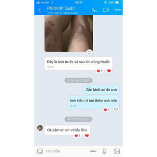 Kem bôi da ITCH KING ( hàng nhập khẩu Mỹ) 1 tuýp