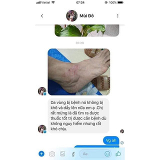 Kem bôi da ITCH KING ( Hàng nhập khẩu Mỹ) 3 tuýp
