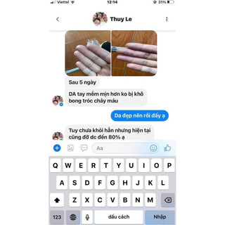 Kem bôi da ITCH KING ( Hàng nhập khẩu Mỹ) 3 tuýp