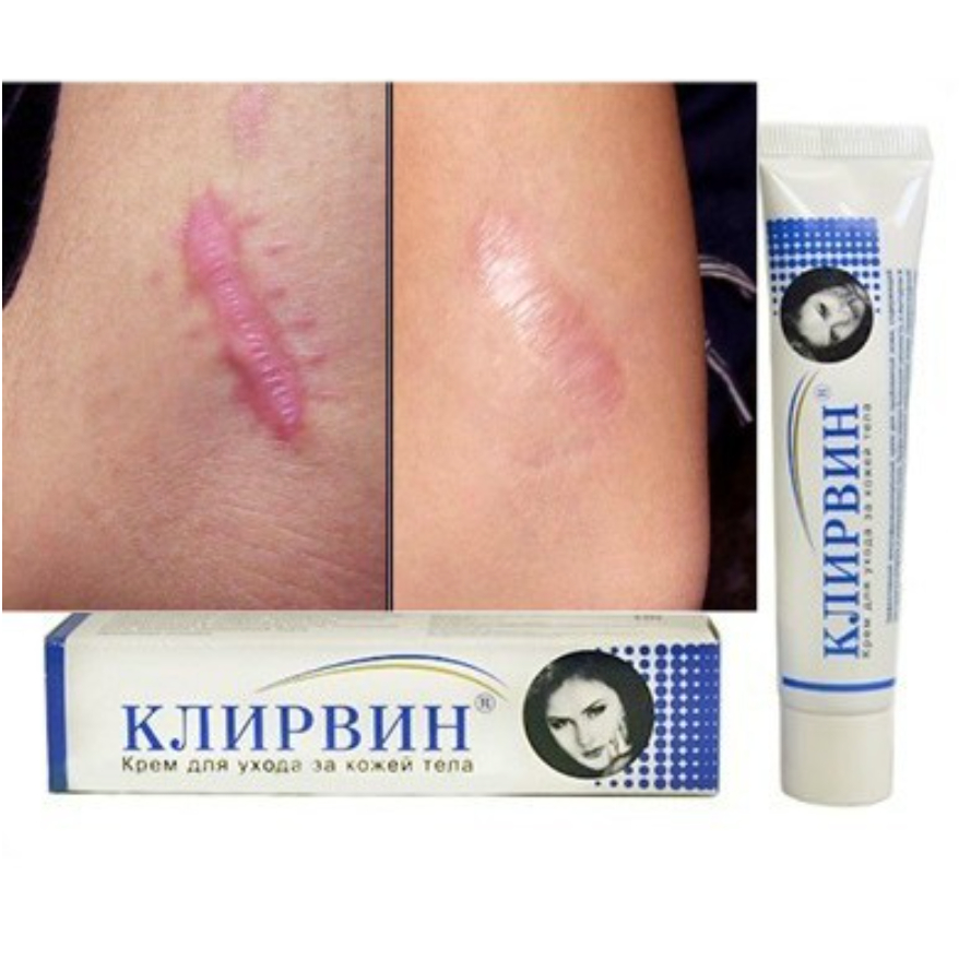 Kem sẹo Nga Klirvin giúp mờ sẹo lồi - sẹo lõm - sẹo rỗ - mờ thâm - 25gr - MA Shop