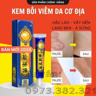 Kem Bôi Nấm Ngứa Viêm Da Cơ Địa Hỗ Trợ Dứt Điểm Hắc Lào, Nấm Da Đầu, Ghẻ Nước Hiệu Quả Nhanh - BÀ LÃO XANH