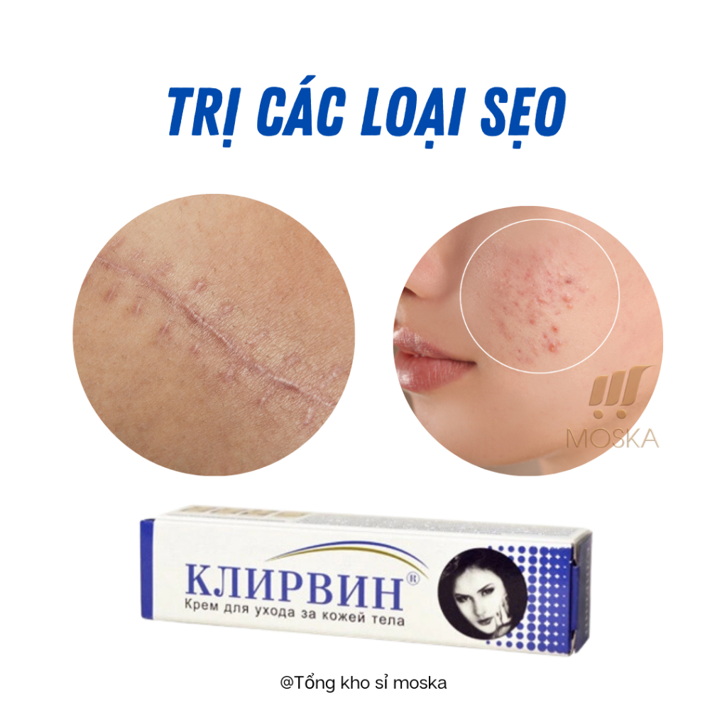 Kem Sẹo Giảm Thâm Sẹo, Giảm Thâm Sẹo Mụn, Vết Rạn Da, Ngừa Sẹo KLIRVIN Nga 25g| Moska Shop