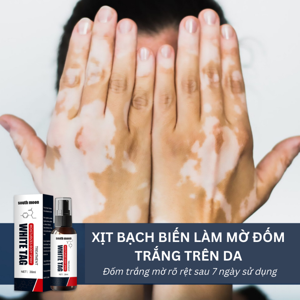 Tinh Chất White Tag Loại Bỏ Nấm Ngứa, Lang Ben, Da Cơ Địa, Bạch Biến, Đốm Trắng Da - Xịt Bạch Biến White Tag 30ml
