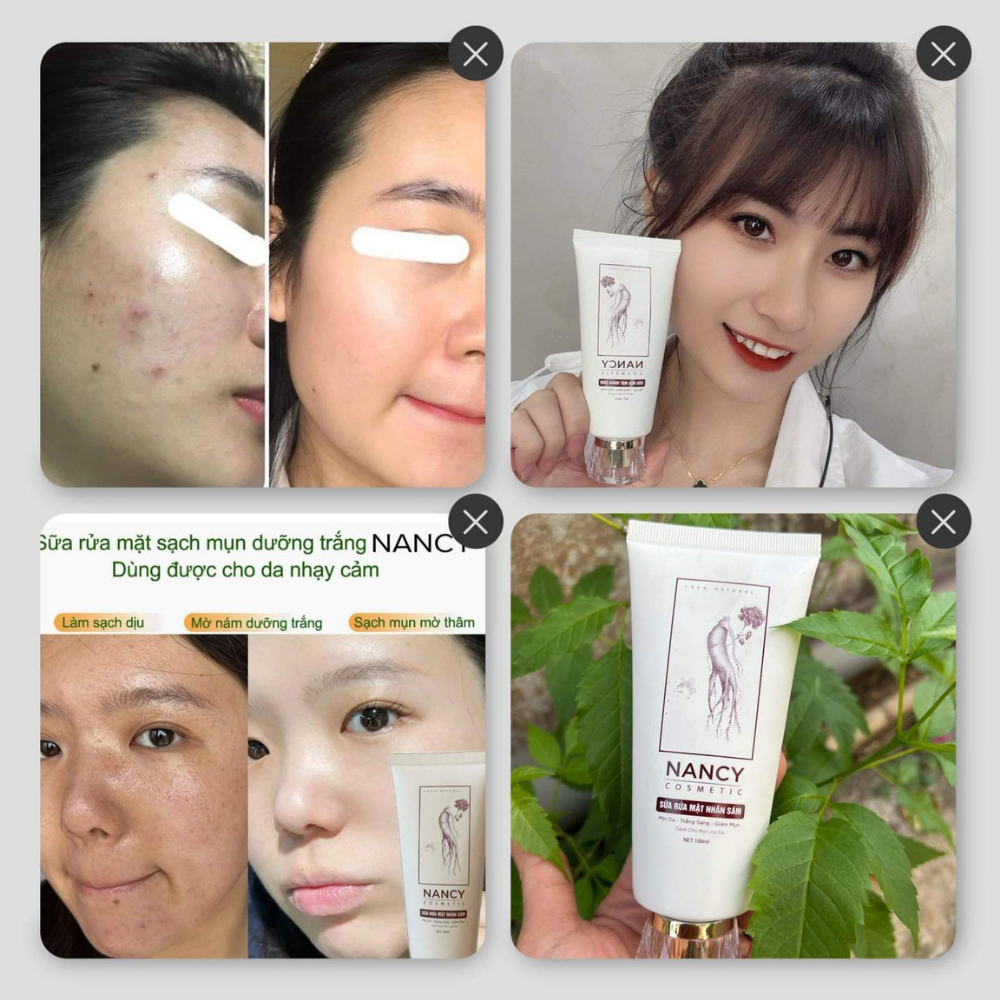 Sữa rửa mặt nhân sâm NANCY - Sữa rửa mặt NANCY giúp trắng da, giảm mụn, kiểm soát dầu, giảm lão hoá - YOUNG BEAUTY