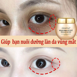  kem dưỡng mắt kem chống lão hóa vùng mắt kem trị thâm mắt 60g Giảm quầng thâm Làm mờ nếp nhăn xóa nếp nhăn và bọng m 