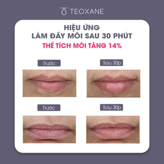 Son dưỡng môi Teoxane 3D LIPS 10ML