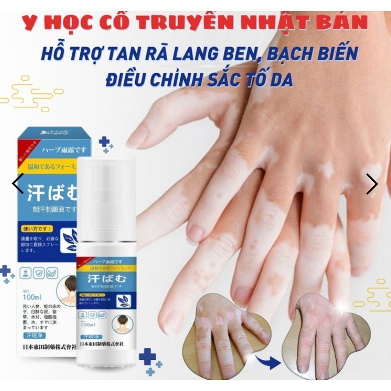 Xịt Bạch Biến Nhật Bản Senko - Xit Thảo Dược Cổ Truyền Senko Làm Đều Tông Màu Da, Xóa Tan Đôm Trắng và Lang Ben