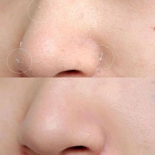 Tẩy da chết Rosette Peeling Gel