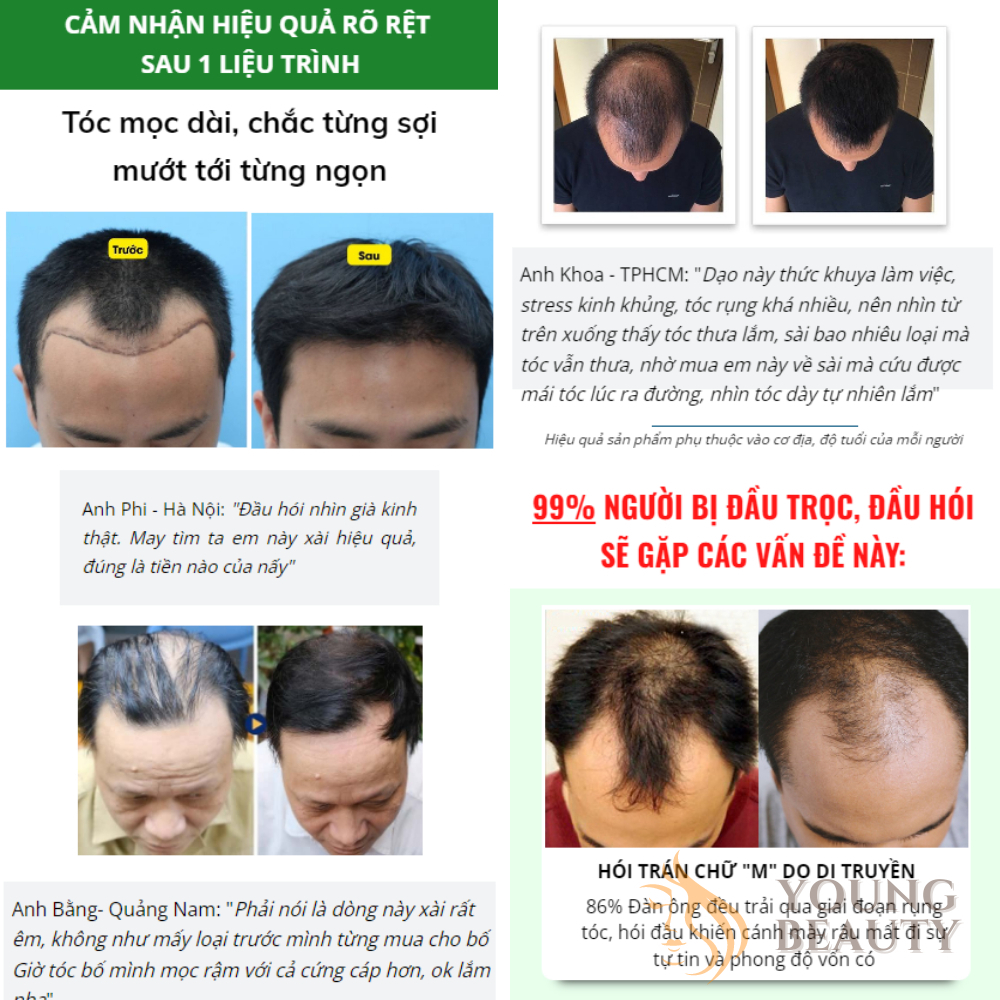 Tinh Chất  Mọc Tóc Neo Hair - Serum Neo Hair Tăng Mọc Tóc, Sinh Mầm Tóc, Ngăn Ngừa Gãy Rụng 120ml.