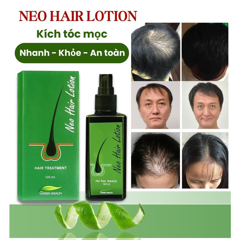 Tinh Chất  Mọc Tóc Neo Hair - Serum Neo Hair Tăng Mọc Tóc, Sinh Mầm Tóc, Ngăn Ngừa Gãy Rụng 120ml.