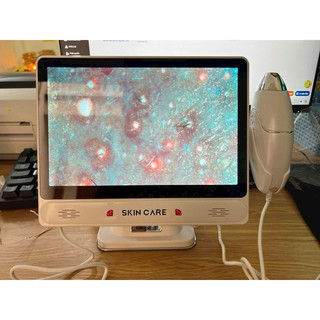 Máy soi da ipad 11inc , máy soi da meiboyi