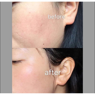 Kem dưỡng da Olay 50ml bản UK