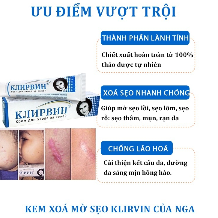 Kem Sẹo KLIRVIN NGA Mờ Sẹo Giảm Thâm Tuýp 25ML
