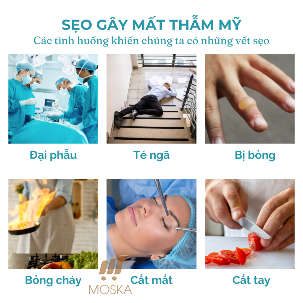 Kem Phục Hồi Sẹo, Ngăn Ngừa Hình Thành Sẹo, Giảm sẹo, Giảm sắc tố da, Phục Hồi Sẹo Công Thức Nhật Bản 30g| Moska Shop