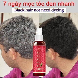 Xịt đen tóc Tinh chất đen tóc100ml đen Phục hồi tóc đen tự Chiết xuất thảo dược,ngăn rụng tóc