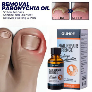 Serum nấm móng serum phục hồi nấm móng dưỡng móng tay dưỡng móng chân,cải thiện móng yếu,nail nấm