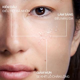 Serum Compliment Giảm Mụn Mờ Thâm Trắng Da Se Lỗ Chân Lông 27ml