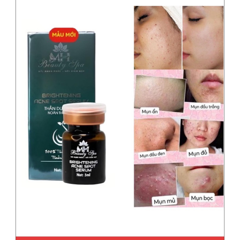 Noãn thực vật, thần dược Mh brightening acne spot serum ( serum mụn làm sáng da)
