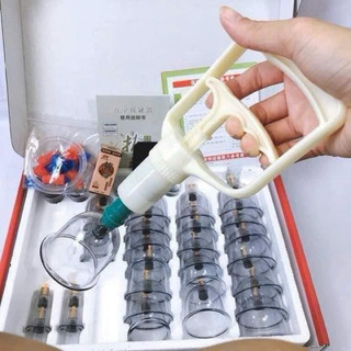 Bộ giác hơi khong dùng lưa- bộ giác 32 cốc kèm một lọ dầu xoa bóp tam thất 50 ml