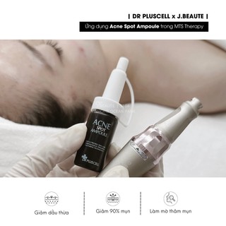 Siêu phẩm tế bào gốc mụn thần tốc Dr Pluscell_ Serum Hàn Quốc