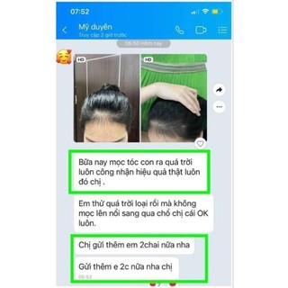 Xịt Kích Mọc Tóc Tuệ Vi Chính Hãng