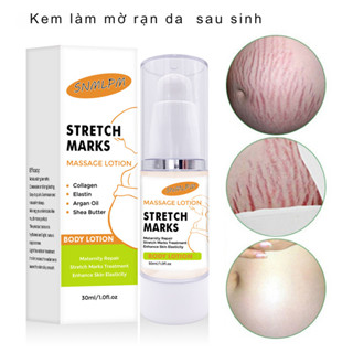 Kem Rạn Da Stretch Marks Cream Hỗ Trợ Mờ Rạn Da, Mờ Sẹo Thâm, Đều Màu Sau Sinh 30ml