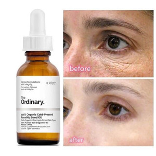 SERUM THÂM MẮT,DƯỠNG MẮT,BỌNG MẮT, VẾT CHÂN CHIM THE ORDINARY.