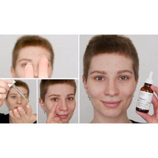 SERUM THÂM MẮT,DƯỠNG MẮT,BỌNG MẮT, VẾT CHÂN CHIM THE ORDINARY.