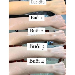 Combo Trắng Da Alpha Arbutin