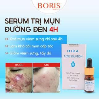 Gel giảm mụn, gel xóa mụn 4h, hika acne treatment