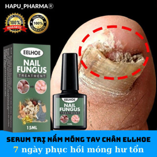 Serum Trị Nấm Móng Tay Chân ELLHOE Hết Sạch Nấm, Bọng Móng, Hư Khoé Nước Ăn Tay Chân Dưỡng Cứng Móng