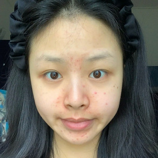 Serum cấp ẩm, phục hồi da Medik8 Hydr8 B5 Hydration 60ml