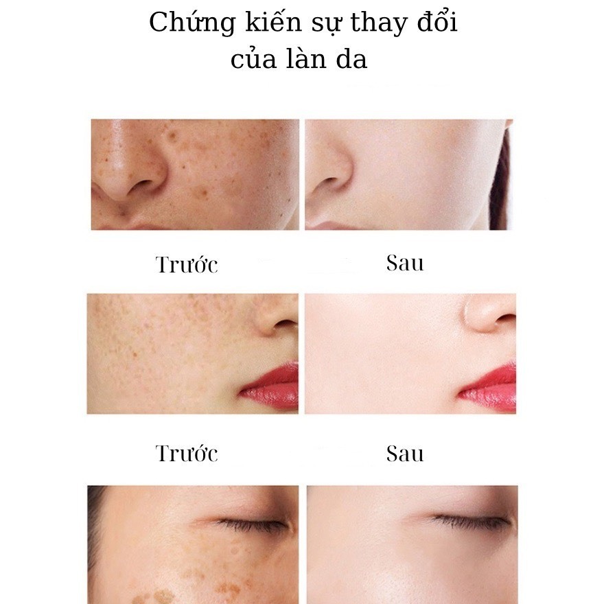 Kem Dưỡng Mờ Nám YOUBUY HISSES Dưỡng Ẩm Trắng Da Mờ Nam Giảm Vết Thâm Mụn